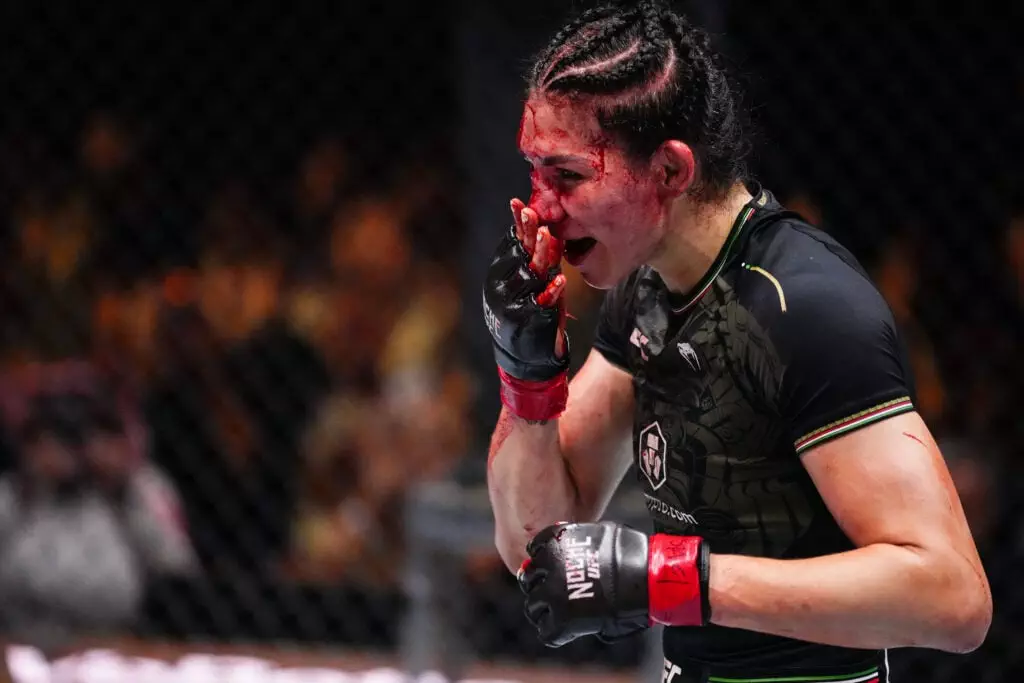 Top Stories Tamfitronics Irene Aldana of Mexico reacts to the end of the round in a bantamweight fight during the UFC 306 at Riyadh Season Noche UFC event at Sphere on Sept...