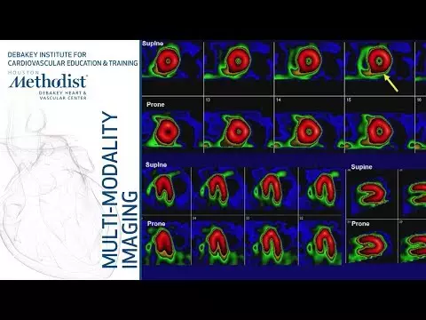 nuclear cardiology instrumentation | Nuclear Cardiology: Understanding the Basics (John J. Mahmarian, MD) October 16, 2018