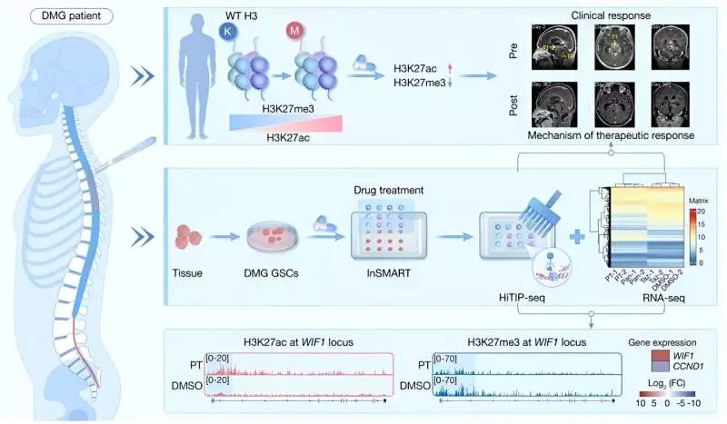 Technology tamfitronics HiTIP-seq profiles epigenomic reprogramming of patient-derived diffuse midline glioma stem cells to epigenetic therapy